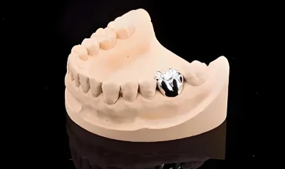 Advantages and disadvantages of pure titanium teeth Advantages and disadvantages of pure titanium teeth